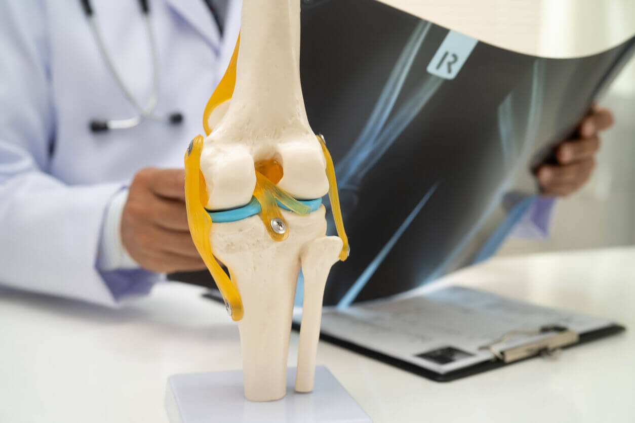 An orthopedic doctor examining knee joint bone radiography xray film.